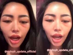 Kondisi Mata Rachel Vennya Jadi Sorotan, Kuasa Hukum Angkat Bicara